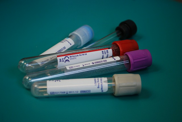This image shows four medical blood collection tubes, commonly known as Vacutainer tubes. The tubes have different colored caps that indicated the type of additive or anticoagulant inside.