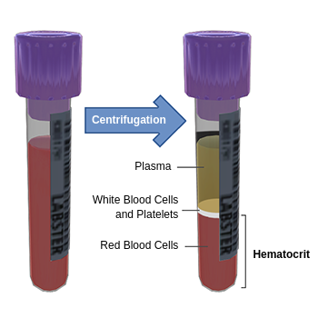 Hematocrit determination This image shows a diagram with two purple-capped test tubes. The first test tube, on the left, is filled with whole blood before processing. An arrow labeled Centrifugation points from the first tube to the second tube on the right. The second tube shows the blood sample separated into three distinct layers, which from top to bottom are plasma in yellow, White Blood Cells and Platelets in white, and Red Blood Cells in red. This red blood cells at the bottom of the tube represent Hematocrit, which is the percentage by volume of red cells in the blood.